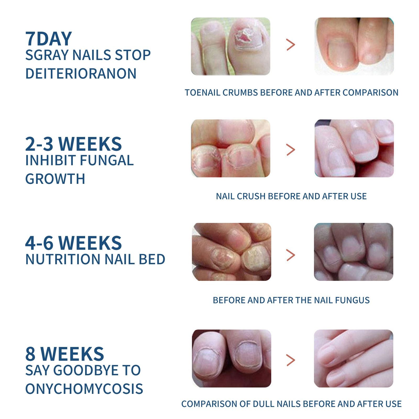 EELHOE Toenail Care Patch Gray Nail Care 468652531