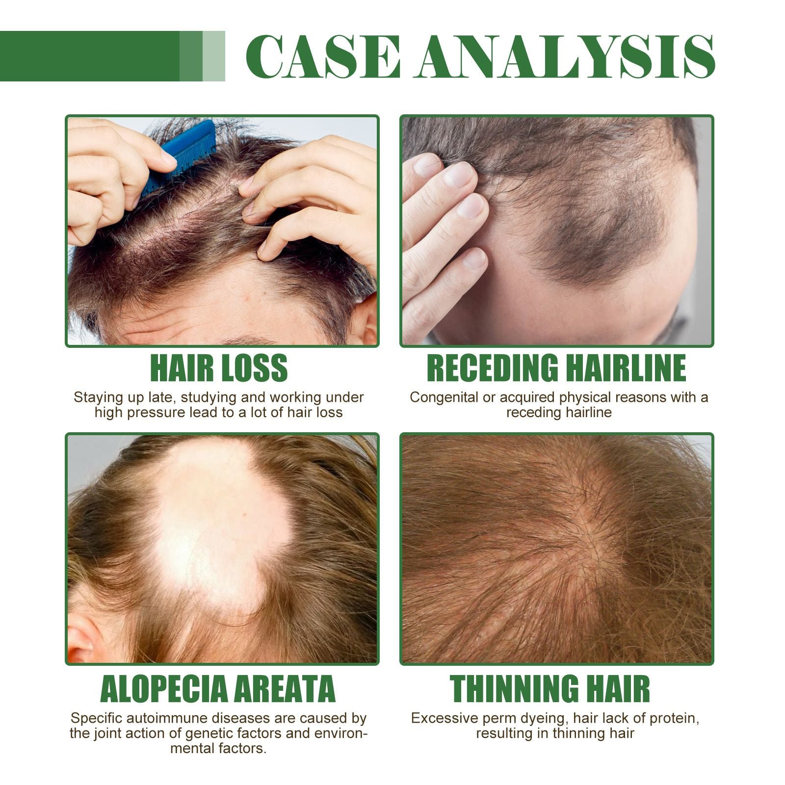 Hoegoa Hair Growth Essential Oil Moisturizer 468729391